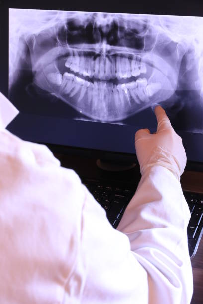 Best Broken or Cracked Tooth Emergency Dentist in Plymouth, PA