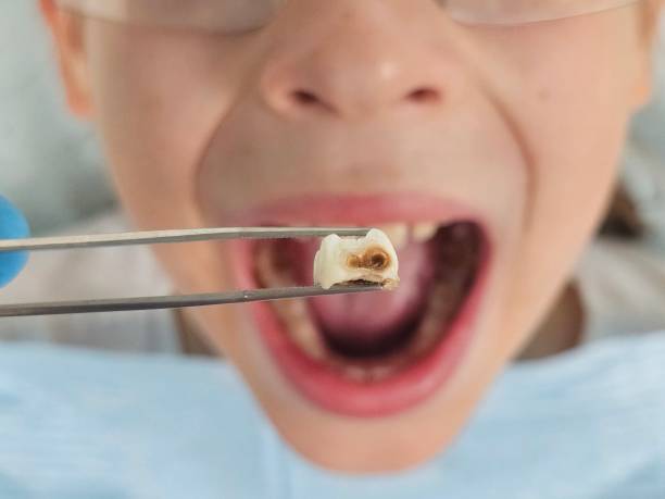 Best Emergency Dental Services for Seniors in Plymouth, PA
